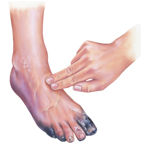 Применение